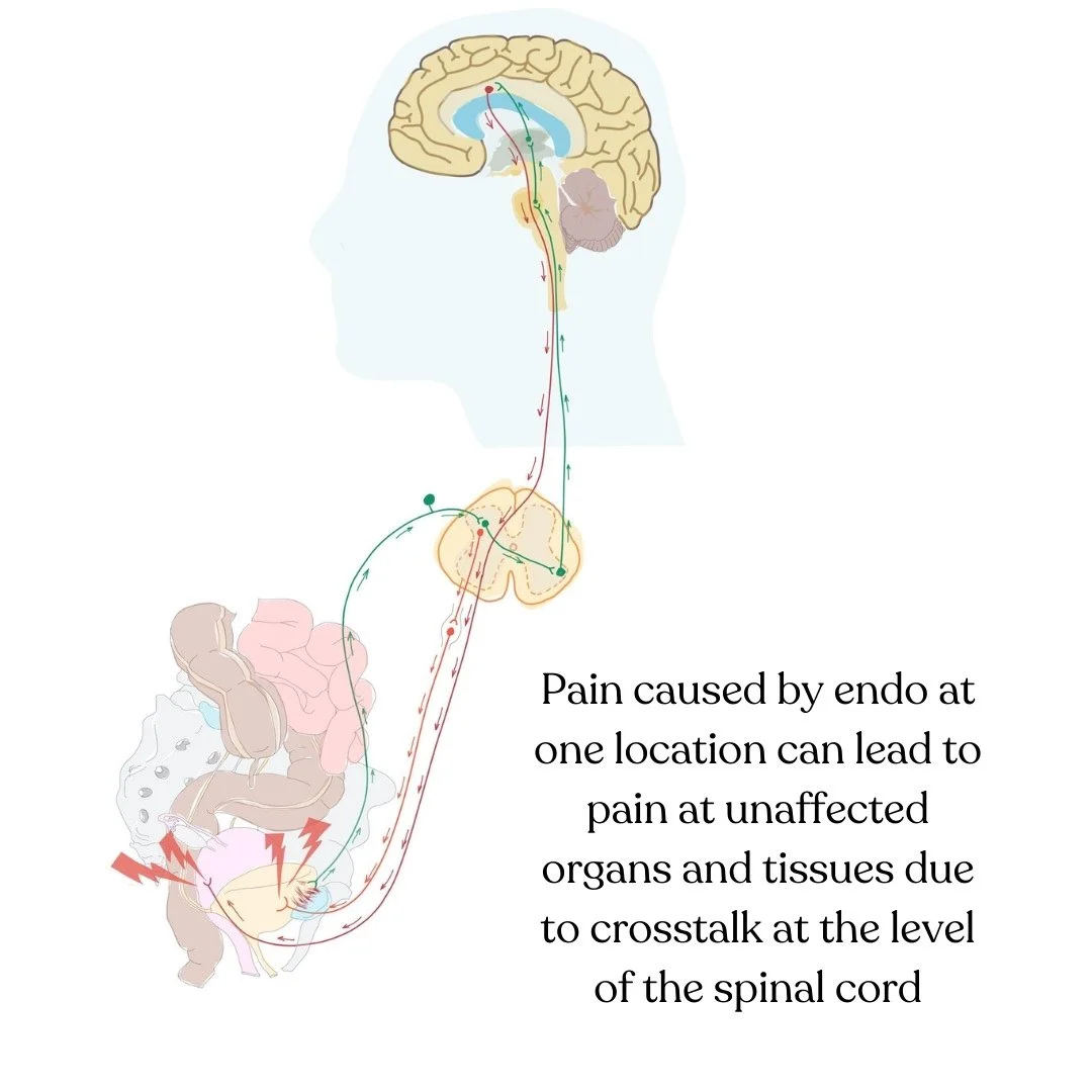 endometriosis pain cross talk Bethany Hansen