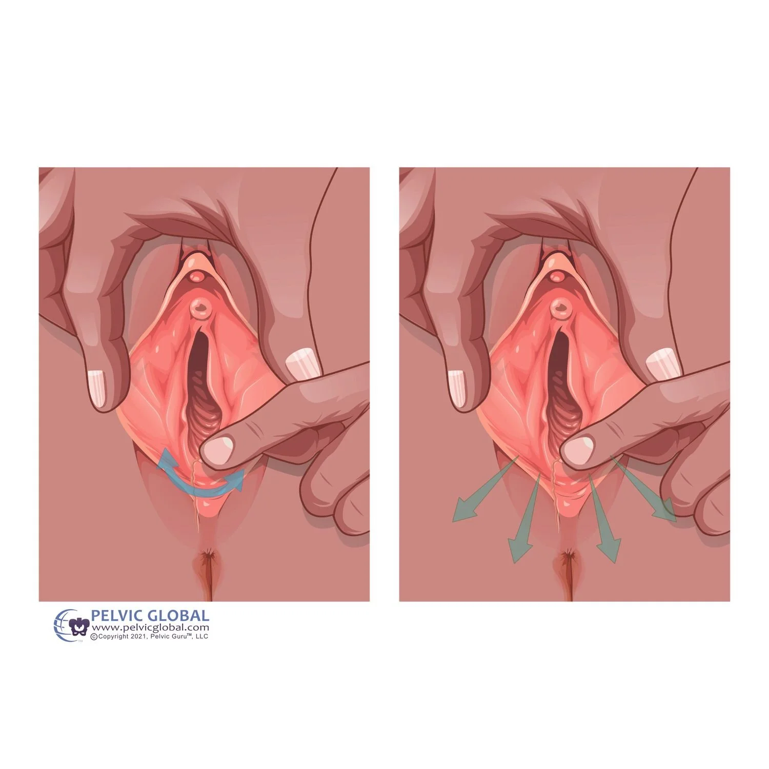 perineal stretching during pregnancy to prepare for birth pelvic floor physical therapy