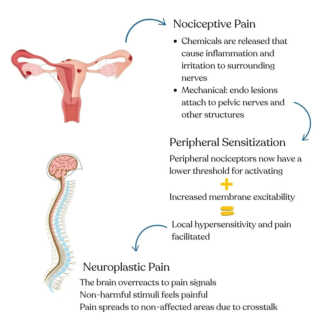 endometriosis nociceptive pain infographic Bethany Hansen