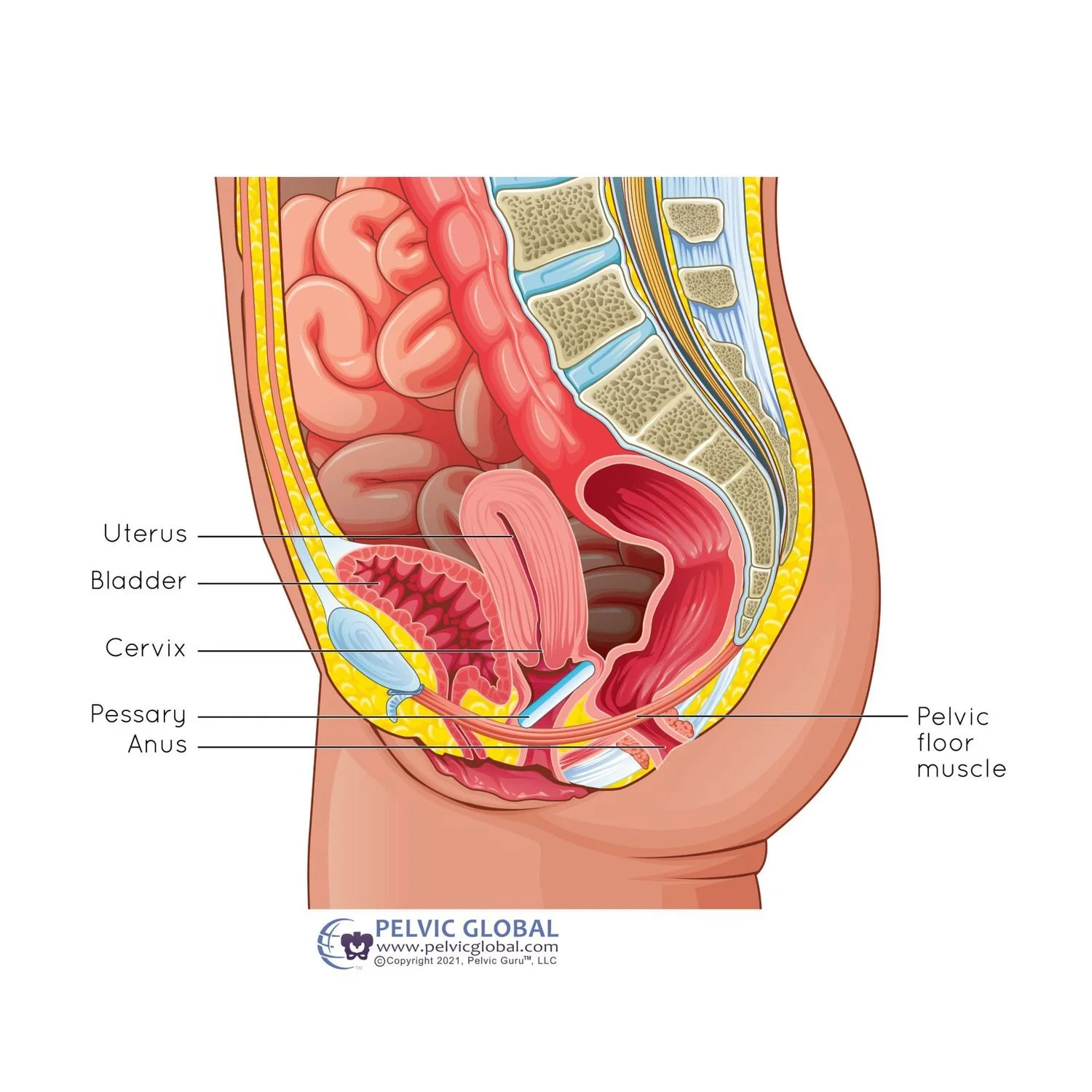 pessary for pelvic organ prolapse physical therapy