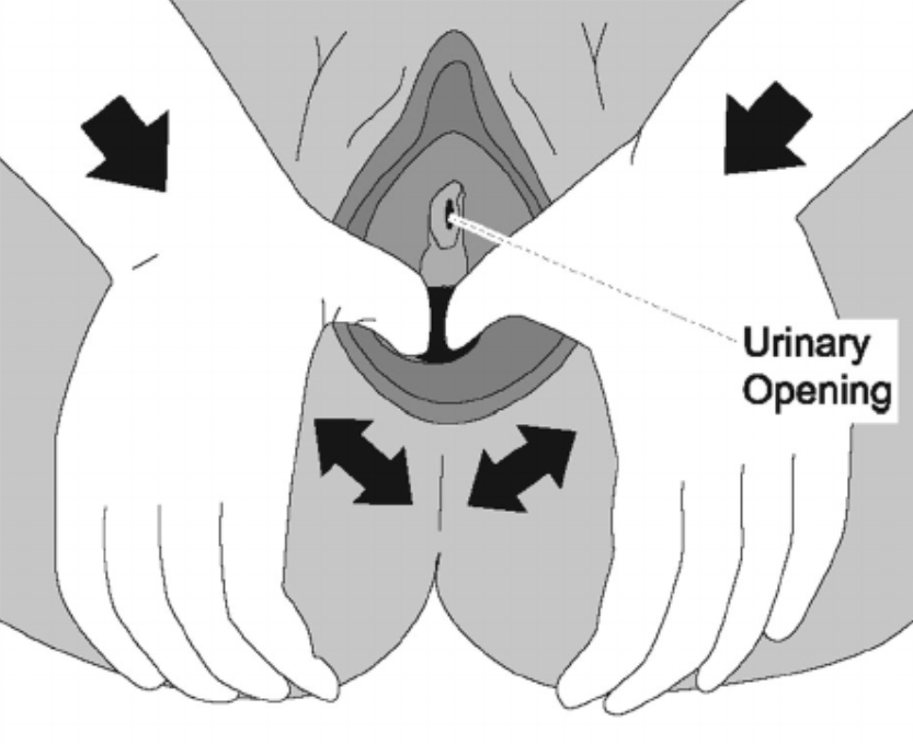 perineal-stretching-vaginal-birth-prep-physical-therapy-Bethany-Hansen-PT-pelvic-floor.PNG